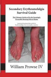William E. Prowse IV, Lillie Lemon - Secondary Erythromelalgia Survival Guide, Häftad. Tillgänglighet: Lägg i varukorg