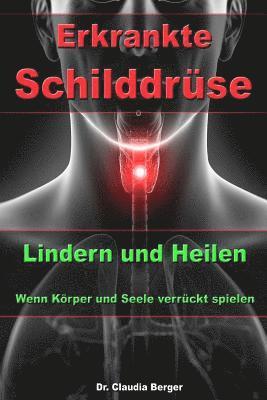 Claudia Berger - Erkrankte Schilddrüse - Lindern und Heilen - Wenn Körper und Seele verrückt spielen, Häftad. Tillgänglighet: Lägg i varukorg