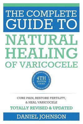 Daniel Johnson - The Complete Guide to Natural Healing of Varicocele: Varicocele natural treatment without surgery, Häftad. Tillgänglighet: Lägg i varukorg