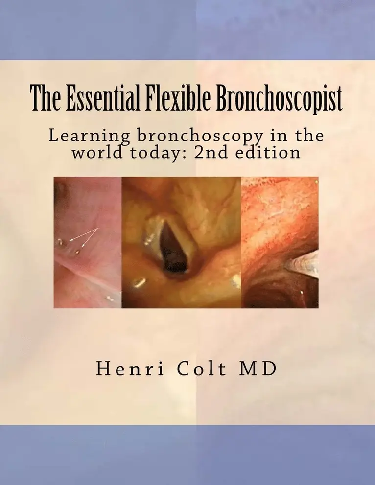 Henri Colt - Essential Flexible Bronchoscopist, Häftad. Tillgänglighet: Lägg i varukorg