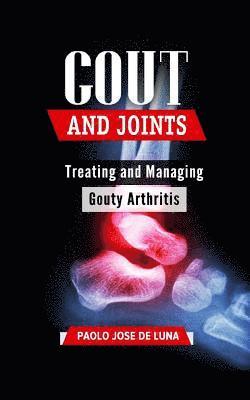 Paolo Jose De Luna - Gout and Joints: Treating and Managing Gouty Arthritis, Häftad. Tillgänglighet: Lägg i varukorg