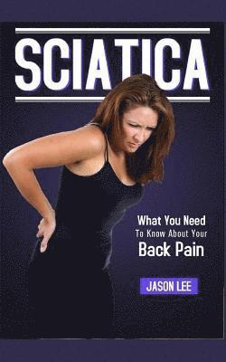 Jason Lee - Sciatica: What You Need To Know About Your Back Pain, Häftad. Tillgänglighet: Lägg i varukorg