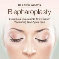 Edwin Williams - Blepharoplasty: Everything You Need to Know about Revitalizing Your Aging Eyes, Häftad
