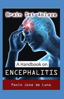 Paolo Jose De Luna - Brain Set Ablaze: A Handbook on Encephalitis, Häftad. Tillgänglighet: Lägg i varukorg