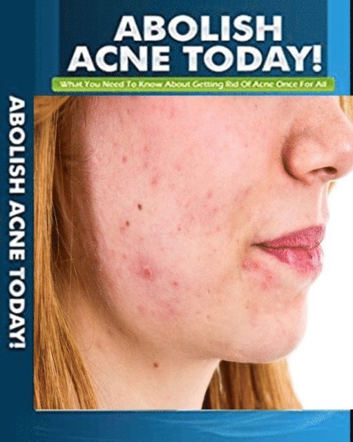 Sharon Burns - Abolish Acne, E-bok