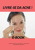 Livre-se da Acne