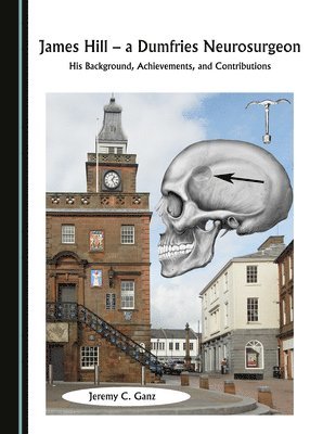 Jeremy C. Ganz - James Hill, a Dumfries Neurosurgeon, Inbunden