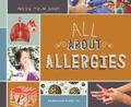 All about Allergies