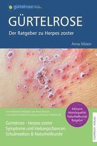 Anna Nilsson - Gürtelrose - Der große Ratgeber zu Herpes zoster: Schulmedizin + Naturheilkunde, Häftad