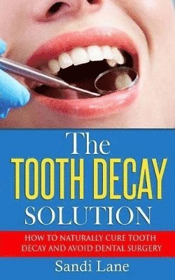 Sandi Lane - Tooth Decay Solution, Häftad. Tillgänglighet: Lägg i varukorg
