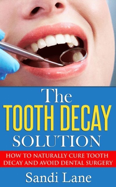 Sandi Lane - Tooth Decay Solution, E-bok. Tillgänglighet: Lägg i varukorg