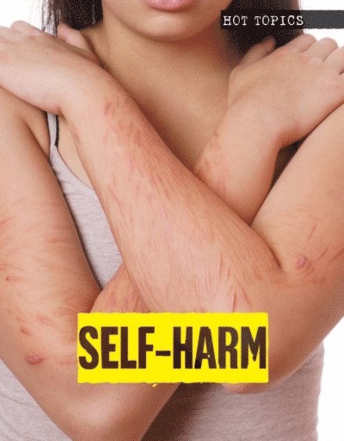 Toney Allman - Self-Harm, E-bok