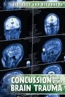 Ryan Nagelhout - Concussions and Other Brain Trauma, Inbunden. Tillgänglighet: Lägg i varukorg