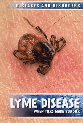 Raymond J. Lampke - Lyme Disease: When Ticks Make You Sick, Inbunden. Tillgänglighet: Lägg i varukorg