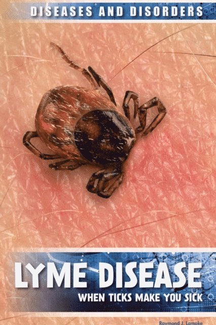 Raymond J. Lampke - Lyme Disease, E-bok. Tillgänglighet: Lägg i varukorg