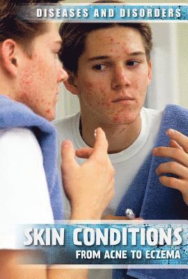 Donna Reynolds - Skin Conditions: From Acne to Eczema, Inbunden. Tillgänglighet: Lägg i varukorg