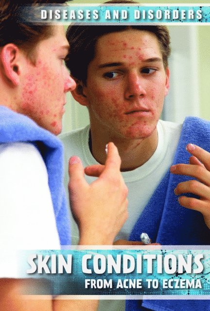 Donna Reynolds - Skin Conditions, E-bok