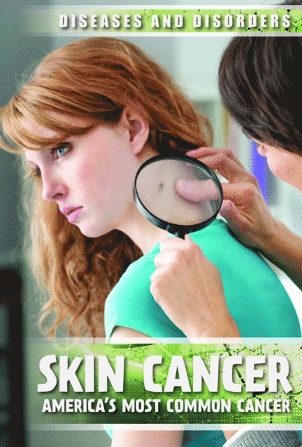 Peter Kurch - Skin Cancer, E-bok. Tillgänglighet: Lägg i varukorg