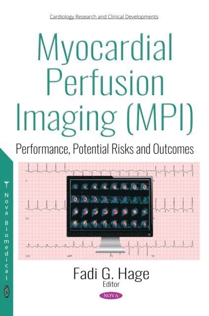 Fadi Gabriel Hage - Myocardial Perfusion Imaging (MPI), E-bok
