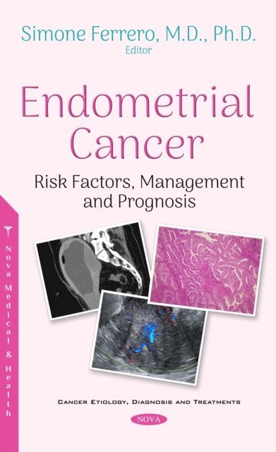 Simone Ferrero - Endometrial Cancer, E-bok. Tillgänglighet: Lägg i varukorg