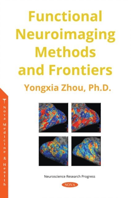 Yongxia Zhou - Functional MRI Methods and Frontiers, E-bok. Tillgänglighet: Lägg i varukorg