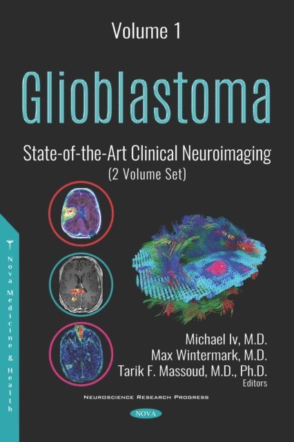 Michael Iv - Glioblastoma: State-of-the-Art Clinical Neuroimaging (2 Volume Set), E-bok