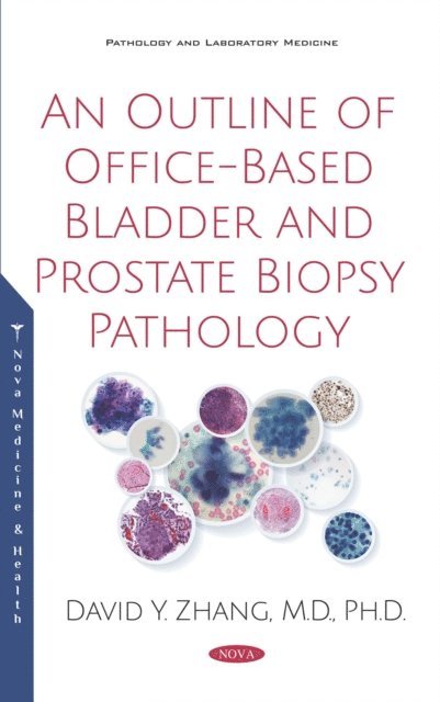 David Y. Zhang - Outline of Office-Based Bladder and Prostate Biopsy Pathology, E-bok