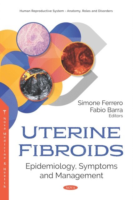 Simone Ferrero - Uterine Fibroids: Epidemiology, Symptoms and Management, E-bok. Tillgänglighet: Lägg i varukorg