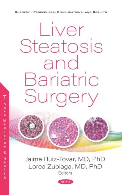 Jaime Ruiz-Tovar - Liver Steatosis and Bariatric Surgery, E-bok. Tillgänglighet: Lägg i varukorg