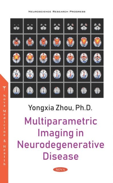 Yongxia Zhou - Multiparametric Imaging in Neurodegenerative Disease, E-bok. Tillgänglighet: Lägg i varukorg