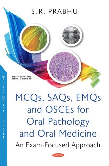 S R Prabhu - MCQs, SAQs, EMQs and OSCEs for Oral Pathology and Oral Medicine: An Exam-Focused Approach, E-bok