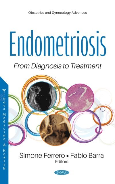 Simone Ferrero - Endometriosis: From Diagnosis to Treatment, E-bok. Tillgänglighet: Lägg i varukorg