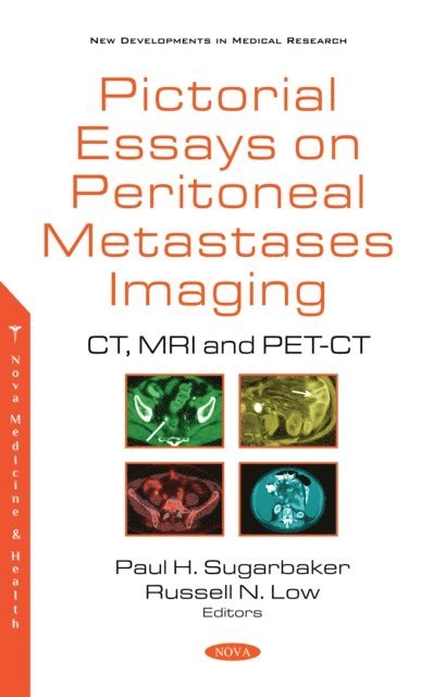 Paul H. Sugarbaker - Pictorial Essays on Peritoneal Metastases Imaging: CT, MRI and PET-CT, E-bok