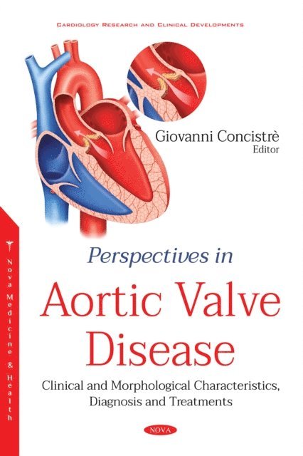 Giovanni Concistre - Perspectives in Aortic Valve Disease: Clinical and Morphological Characteristics, Diagnosis and Treatments, E-bok