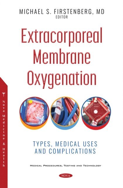 Michael S. Firstenberg - Extracorporeal Membrane Oxygenation: Types, Medical Uses and Complications, E-bok