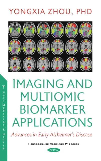 Yongxia Zhou - Imaging and Multiomic Biomarker Applications, E-bok. Tillgänglighet: Lägg i varukorg