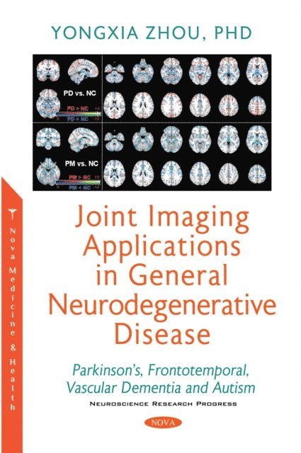 Yongxia Zhou - Joint Imaging Applications in General Neurodegenerative Disease, E-bok. Tillgänglighet: Lägg i varukorg