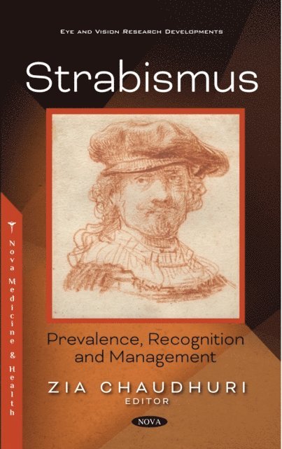 Zia Chaudhuri - Strabismus: Prevalence, Recognition and Management, E-bok