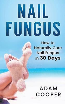 Adam Cooper - Nail Fungus: How to Naturally Cure Nail Fungus in 30 Days: Natural remedies, homeopathy for toenail fungus, Häftad. Tillgänglighet: Lägg i varukorg