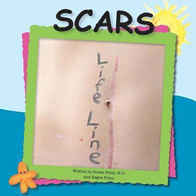 Regen Foley, Susan Foley - Scars, Häftad. Tillgänglighet: Lägg i varukorg