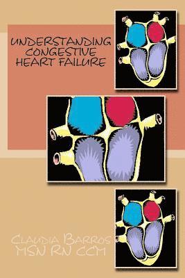 Claudia Barros - Understanding Congestive Heart Failure, Häftad