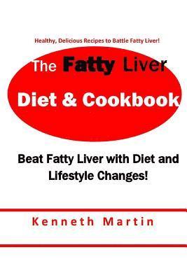 Kenneth Martin - The Fatty Liver Diet & Cookbook: Beat Fatty Liver with Diet & Lifestyle Changes, Häftad. Tillgänglighet: Lägg i varukorg