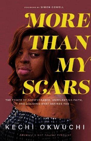 Kechi Okwuchi, Simon Cowell - More Than My Scars – The Power of Perseverance, Unrelenting Faith, and Deciding What Defines You, Häftad