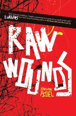 Kondwani Fidel - Raw Wounds, Häftad. Tillgänglighet: Lägg i varukorg