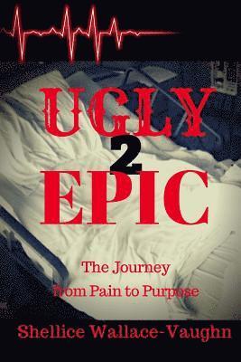 Lisa Bell - Ugly 2 Epic: The Journey from Pain to Purpose, Häftad