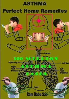 Ram Babu Sao - Asthma-Perfect Home Remedies: Asthma Treatment by Home Remedies, Häftad