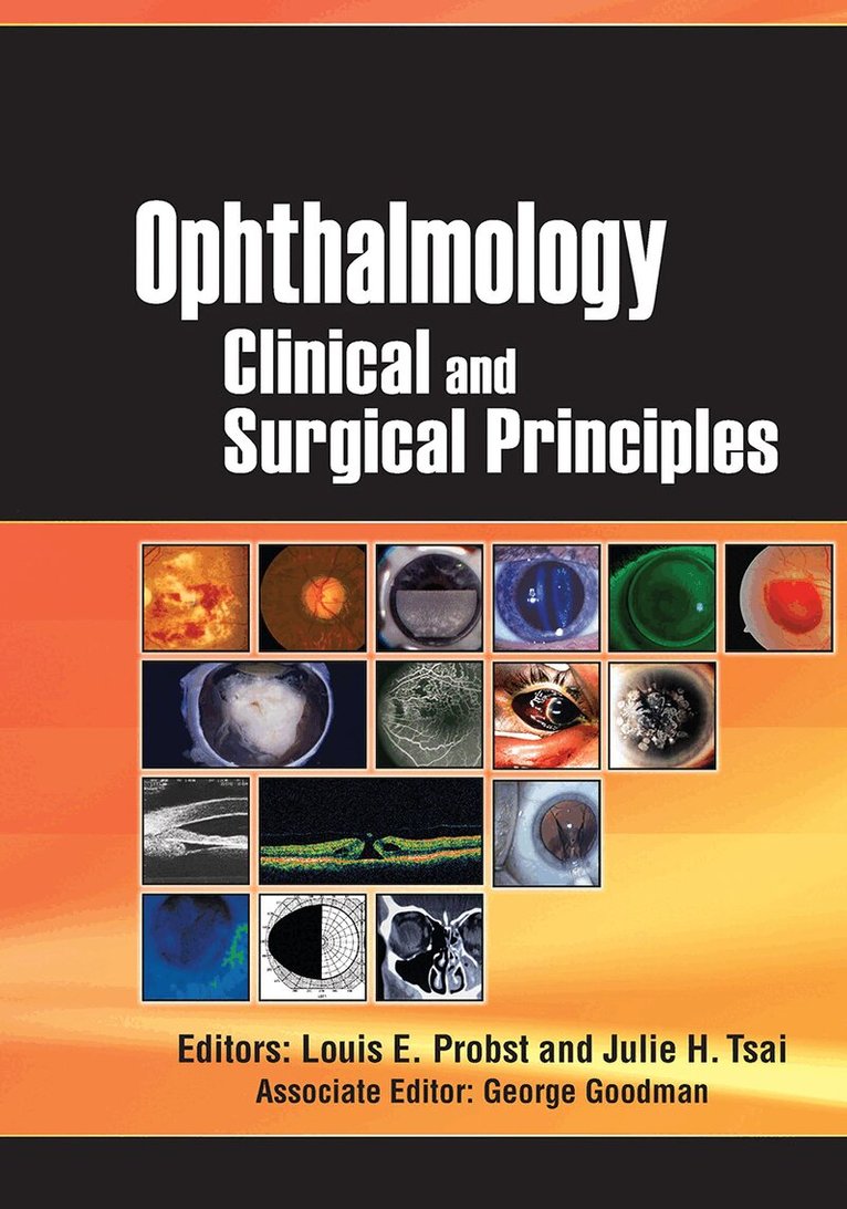 Louis Probst, Julie Tsai - Ophthalmology, Häftad. Tillgänglighet: Lägg i varukorg