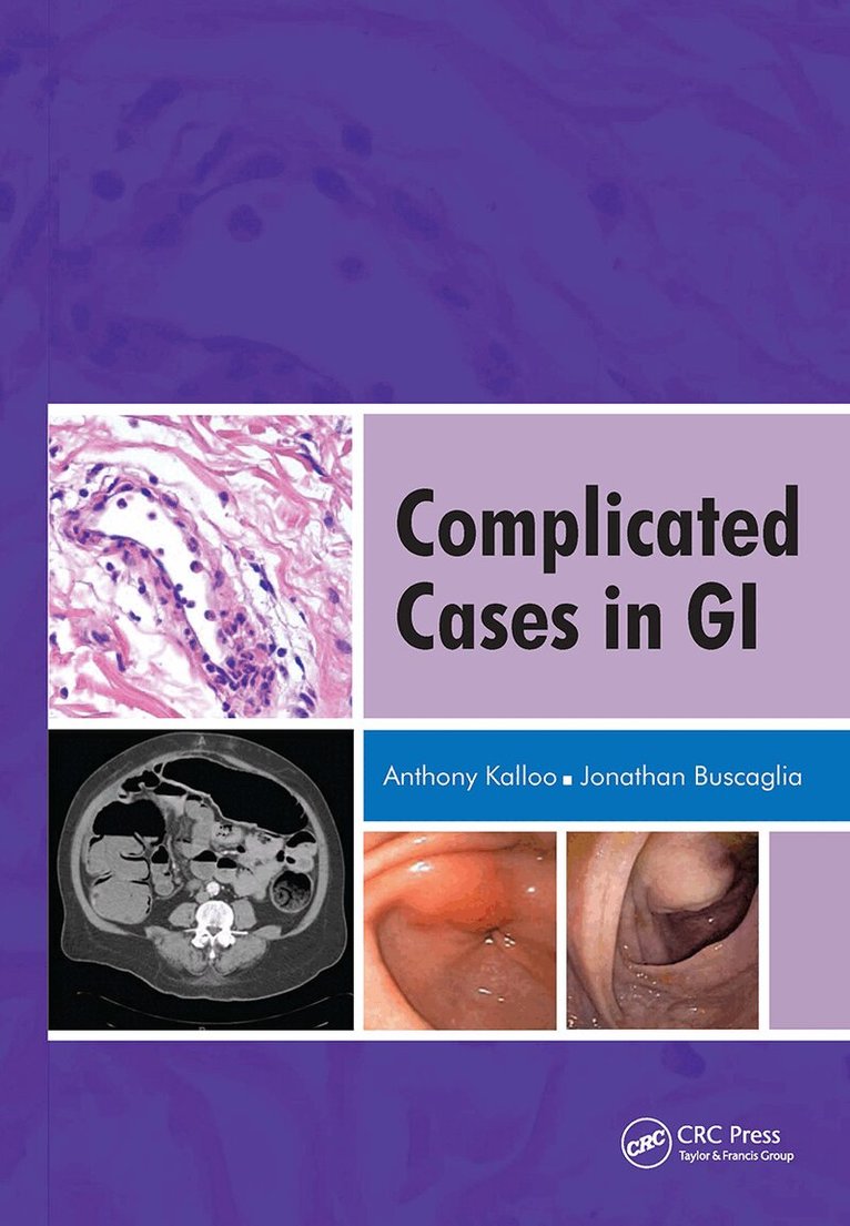 Anthony Kalloo - Complicated Cases in GI, Inbunden. Tillgänglighet: Lägg i varukorg