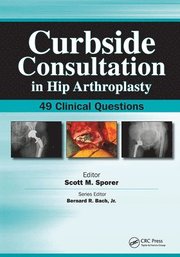 Curbside Consultation in Hip Arthroplasty