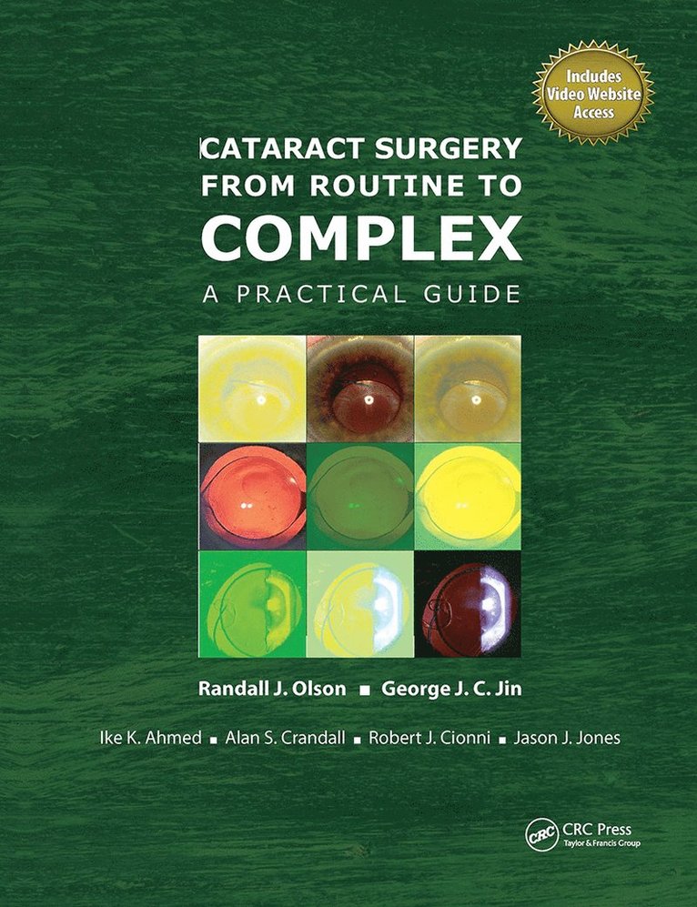 Randall Olson, George Jin, Ike Ahmed, Alan Crandall - Cataract Surgery from Routine to Complex, Inbunden